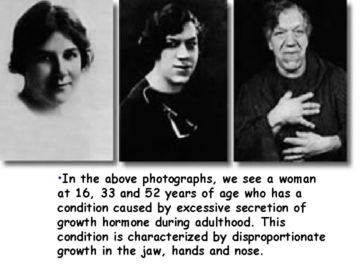  • In the above photographs, we see a woman at 16, 33 and