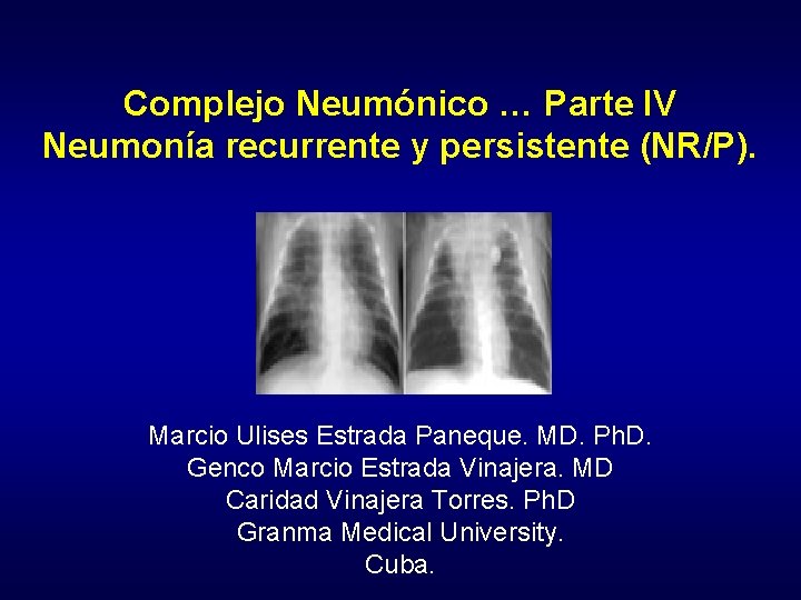 Complejo Neumónico … Parte IV Neumonía recurrente y persistente (NR/P). Marcio Ulises Estrada Paneque.