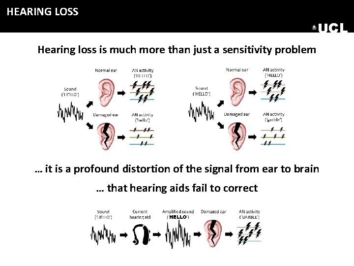 HEARING LOSS UCL Hearing loss is much more than just a sensitivity problem … HEARING LOSS UCL Hearing loss is much more than just a sensitivity problem …