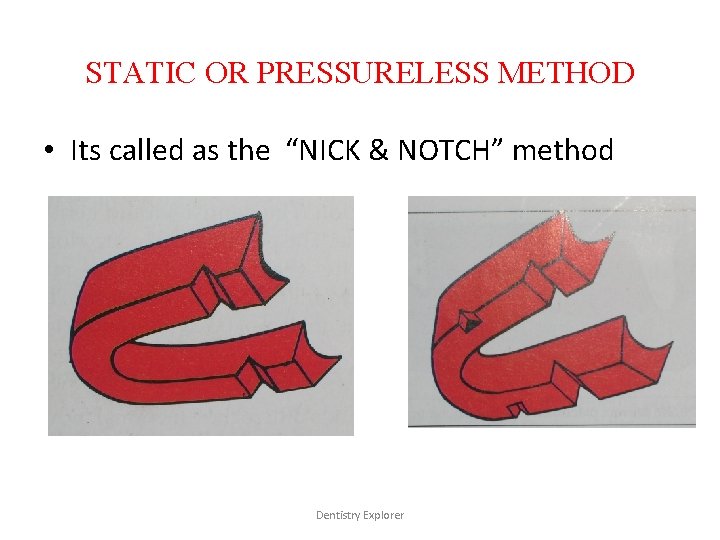 STATIC OR PRESSURELESS METHOD • Its called as the “NICK & NOTCH” method Dentistry