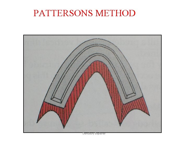 PATTERSONS METHOD Dentistry Explorer 