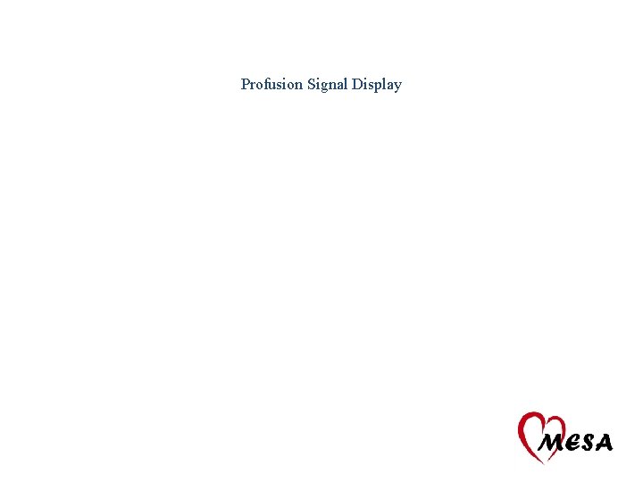 Profusion Signal Display 