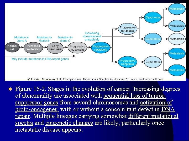 l Figure 16 -2. Stages in the evolution of cancer. Increasing degrees of abnormality