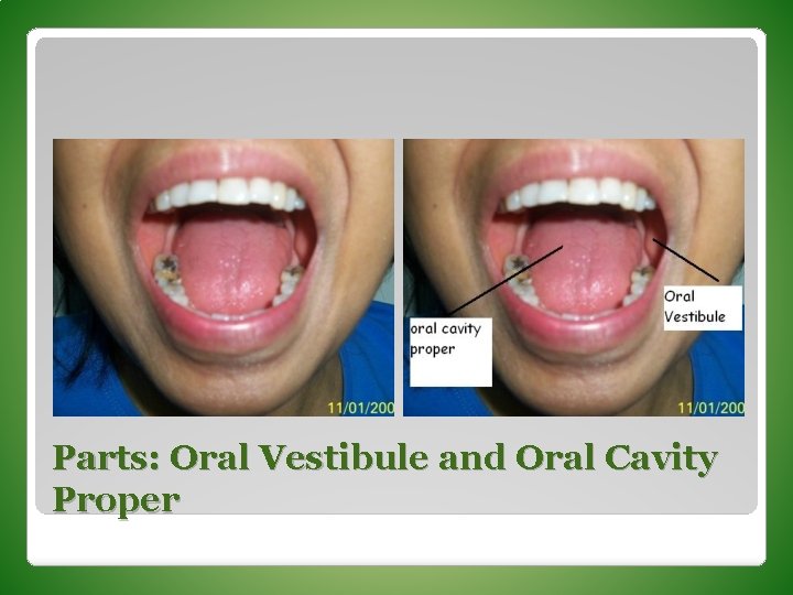 Parts: Oral Vestibule and Oral Cavity Proper 