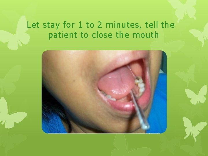 Let stay for 1 to 2 minutes, tell the patient to close the mouth