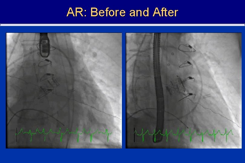 AR: Before and After 