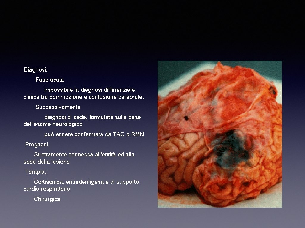 Diagnosi: Fase acuta impossibile la diagnosi differenziale clinica tra commozione e contusione cerebrale. Successivamente