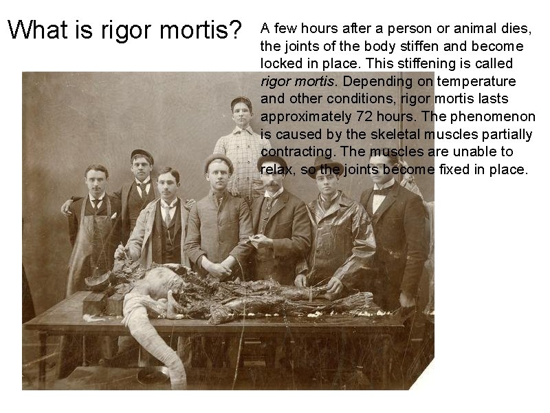 What is rigor mortis? A few hours after a person or animal dies, the