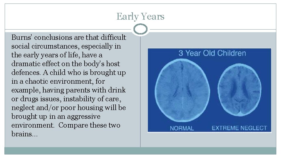 Early Years Burns’ conclusions are that difficult social circumstances, especially in the early years