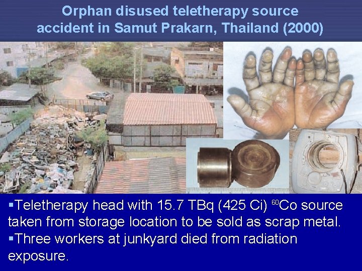 Orphan disused teletherapy source accident in Samut Prakarn, Thailand (2000) §Teletherapy head with 15.