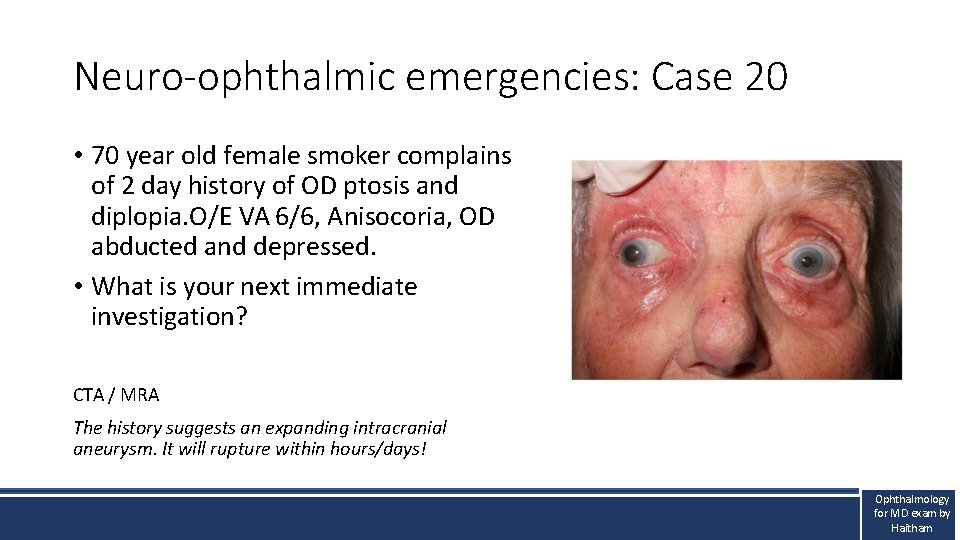 Neuro-ophthalmic emergencies: Case 20 • 70 year old female smoker complains of 2 day Neuro-ophthalmic emergencies: Case 20 • 70 year old female smoker complains of 2 day