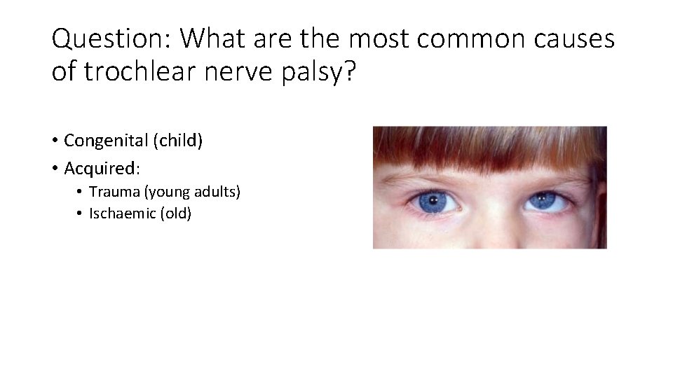 Question: What are the most common causes of trochlear nerve palsy? • Congenital (child) Question: What are the most common causes of trochlear nerve palsy? • Congenital (child)