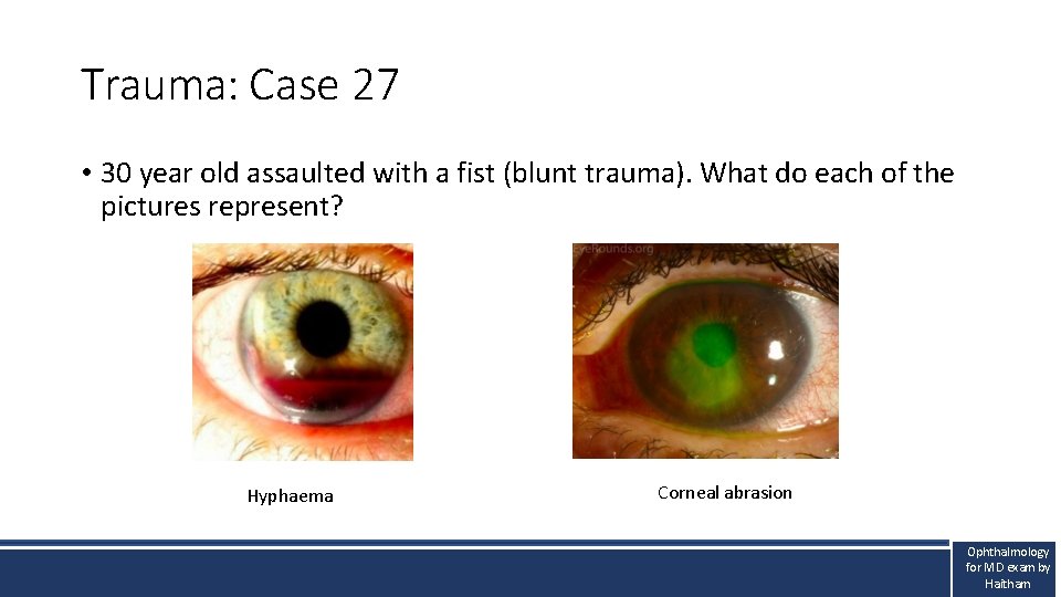 Trauma: Case 27 • 30 year old assaulted with a fist (blunt trauma). What Trauma: Case 27 • 30 year old assaulted with a fist (blunt trauma). What
