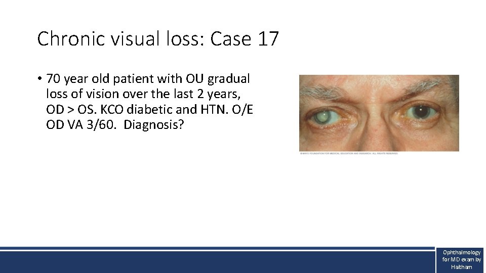 Chronic visual loss: Case 17 • 70 year old patient with OU gradual loss Chronic visual loss: Case 17 • 70 year old patient with OU gradual loss