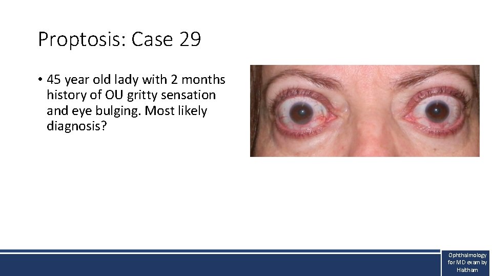 Proptosis: Case 29 • 45 year old lady with 2 months history of OU Proptosis: Case 29 • 45 year old lady with 2 months history of OU