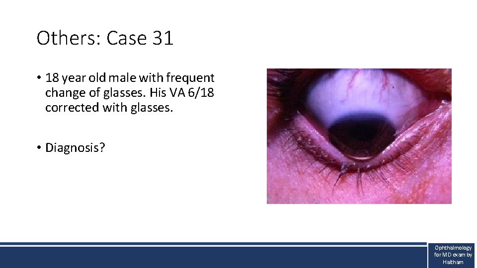 Others: Case 31 • 18 year old male with frequent change of glasses. His Others: Case 31 • 18 year old male with frequent change of glasses. His