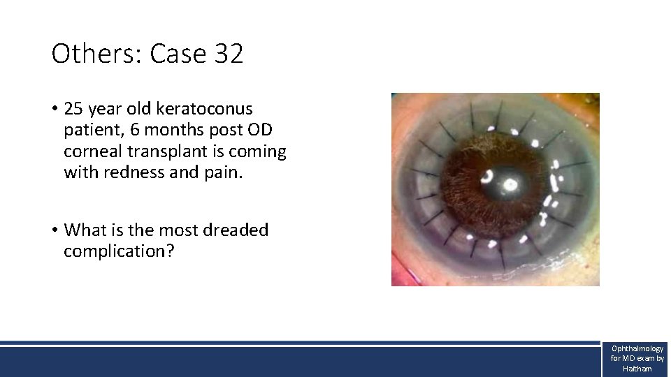 Others: Case 32 • 25 year old keratoconus patient, 6 months post OD corneal Others: Case 32 • 25 year old keratoconus patient, 6 months post OD corneal