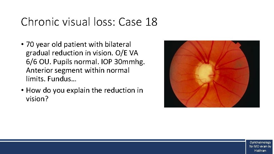 Chronic visual loss: Case 18 • 70 year old patient with bilateral gradual reduction Chronic visual loss: Case 18 • 70 year old patient with bilateral gradual reduction