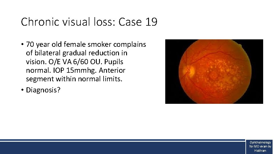 Chronic visual loss: Case 19 • 70 year old female smoker complains of bilateral Chronic visual loss: Case 19 • 70 year old female smoker complains of bilateral