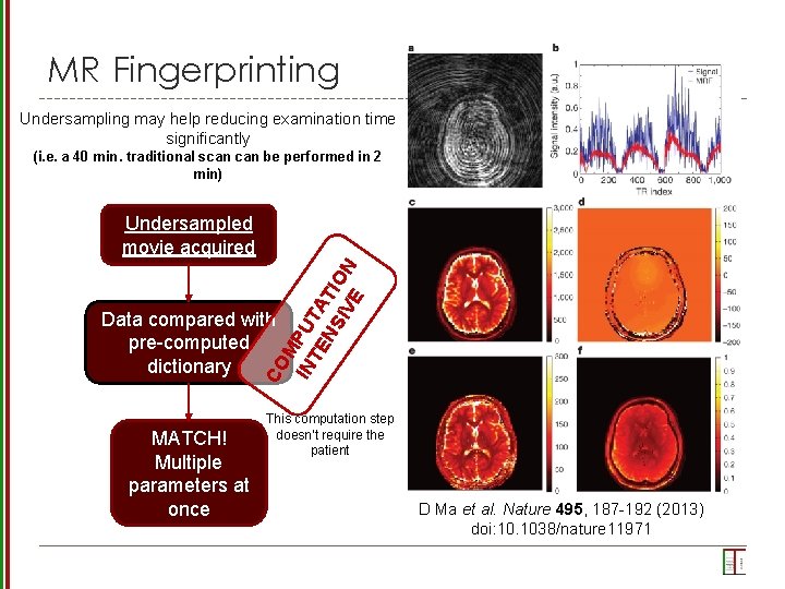 MR Fingerprinting Undersampling may help reducing examination time significantly (i. e. a 40 min.