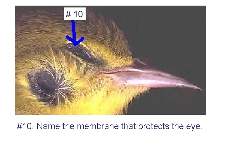 # 10 #10. Name the membrane that protects the eye. 