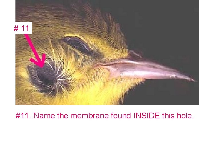 # 11 #11. Name the membrane found INSIDE this hole. 