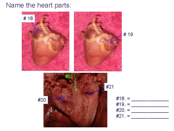 Name the heart parts: # 18 # 19 #22 #21 #20 #18. = _______
