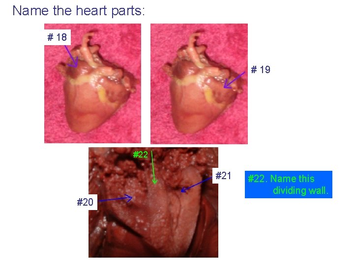 Name the heart parts: # 18 # 19 #22 #21 #20 #22. Name this