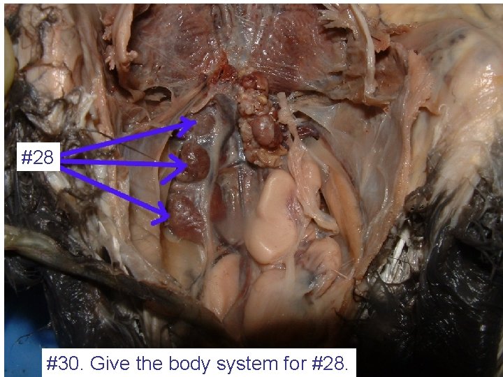 #28 #30. Give the body system for #28. 