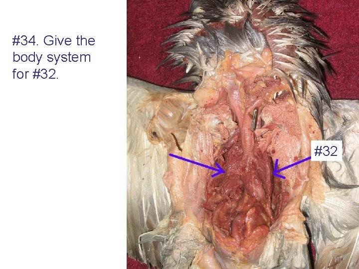 #34. Give the body system for #32 