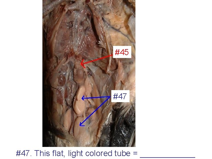 #45 #47. This flat, light colored tube = ______ 