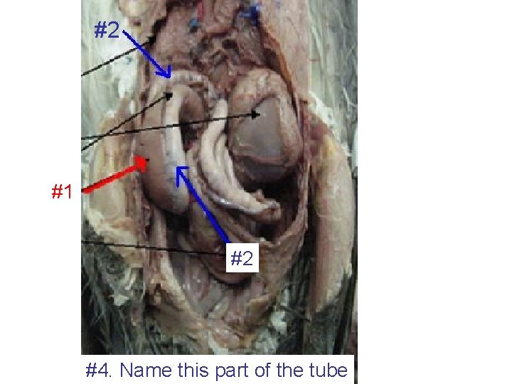 #2 #1 #2 #4. Name this part of the tube 