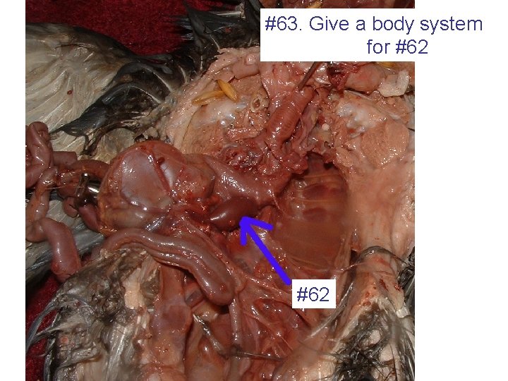 #63. Give a body system for #62 