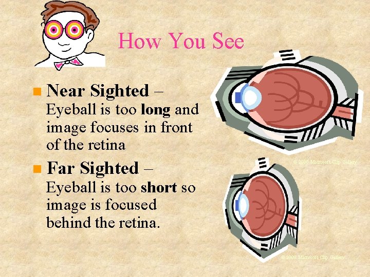 How You See Near Sighted – Eyeball is too long and image focuses in