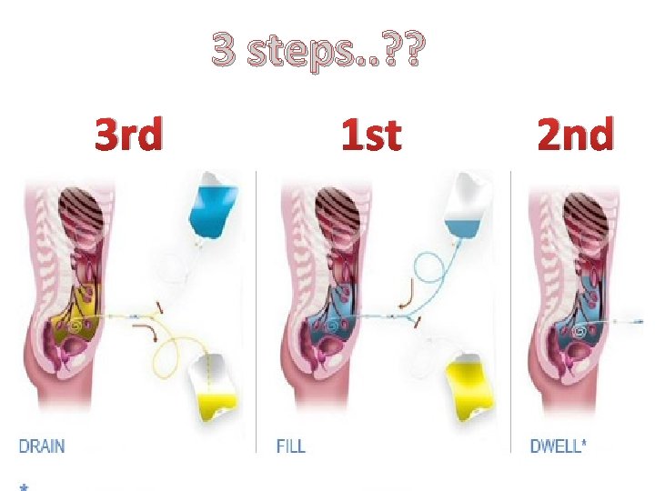 3 steps. . ? ? 3 rd 1 st 2 nd 