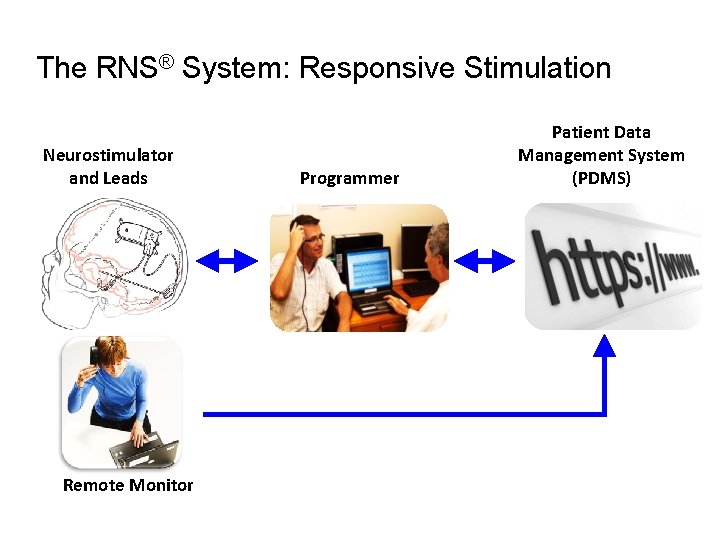 The RNS® System: Responsive Stimulation Neurostimulator and Leads Remote Monitor Programmer Patient Data Management