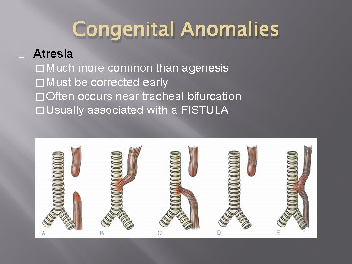 Congenital Anomalies � Atresia � Much more common than agenesis � Must be corrected