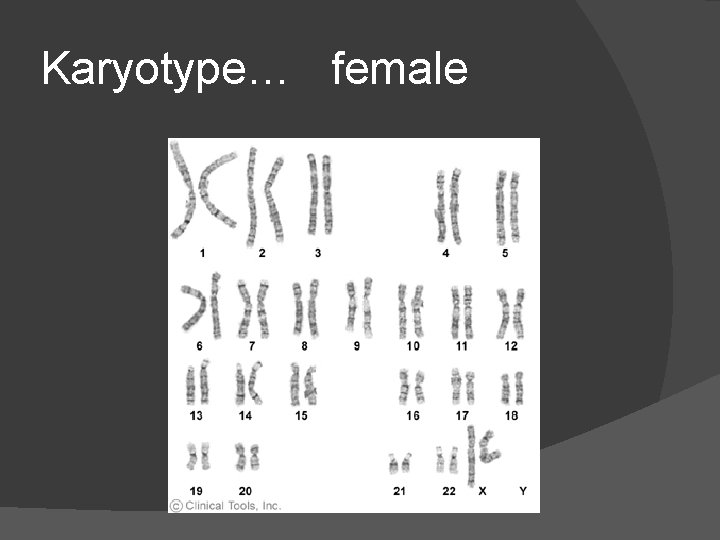 Karyotype… female 