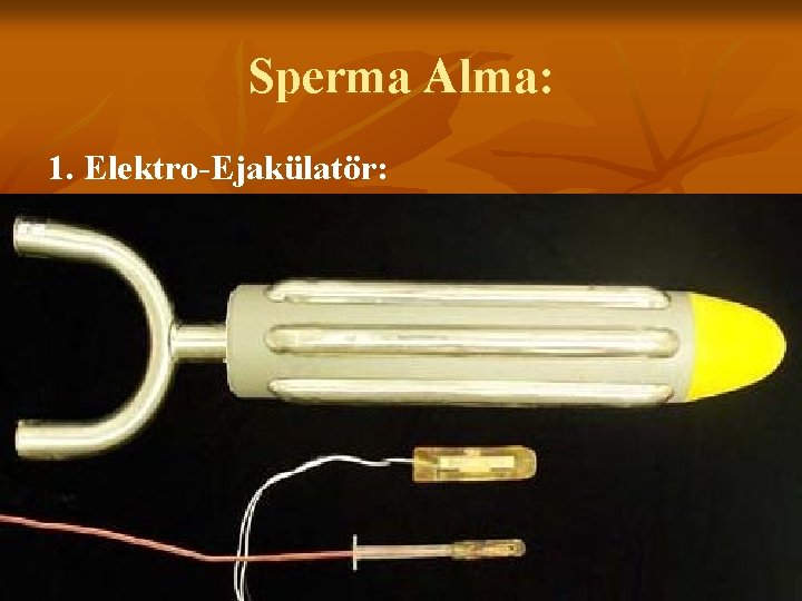 Sperma Alma: 1. Elektro-Ejakülatör: 