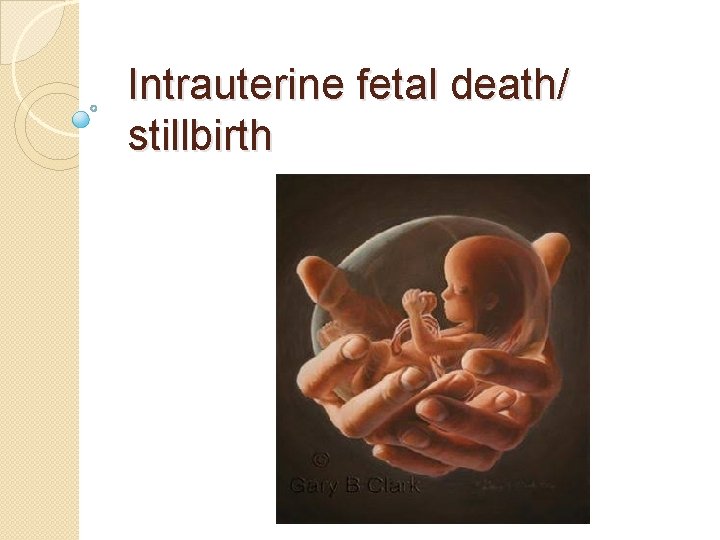 Intrauterine fetal death/ stillbirth 