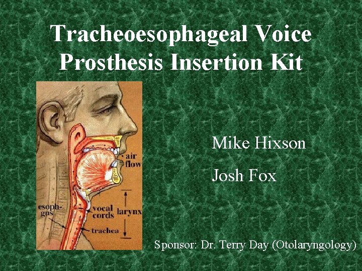 Tracheoesophageal Voice Prosthesis Insertion Kit Mike Hixson Josh Fox Sponsor: Dr. Terry Day (Otolaryngology)