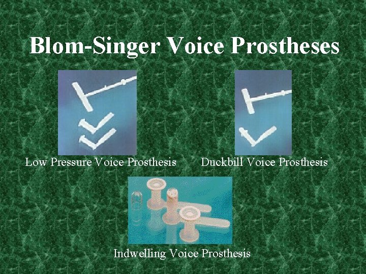Blom-Singer Voice Prostheses Low Pressure Voice Prosthesis Duckbill Voice Prosthesis Indwelling Voice Prosthesis 