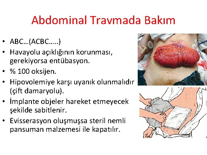 Abdominal Travmada Bakım • ABC…(ACBC…. . ) • Havayolu açıklığının korunması, gerekiyorsa entübasyon. •