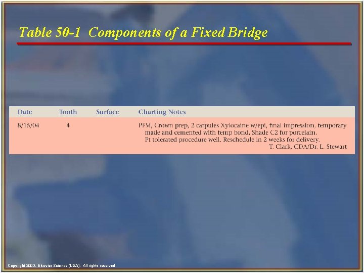 Table 50 -1 Components of a Fixed Bridge Copyright 2003, Elsevier Science (USA). All