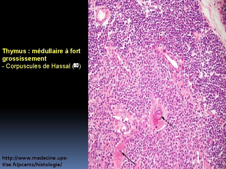 Thymus : médullaire à fort grossissement - Corpuscules de Hassal ( ) http: //www. Thymus : médullaire à fort grossissement - Corpuscules de Hassal ( ) http: //www.