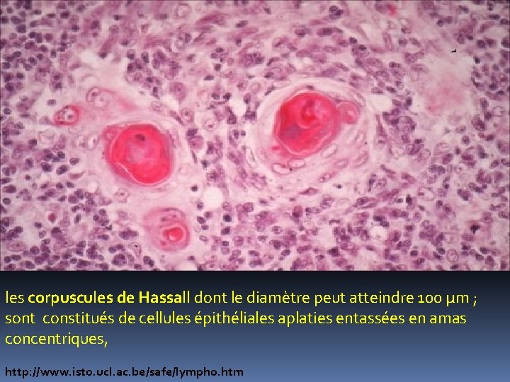 les corpuscules de Hassall dont le diamètre peut atteindre 100 μm ; sont constitués les corpuscules de Hassall dont le diamètre peut atteindre 100 μm ; sont constitués