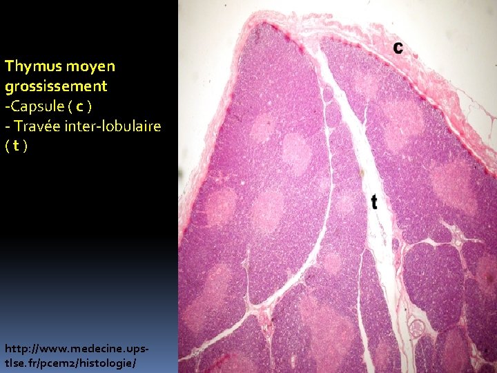 Thymus moyen grossissement -Capsule ( c ) - Travée inter-lobulaire ( t ) http: Thymus moyen grossissement -Capsule ( c ) - Travée inter-lobulaire ( t ) http: