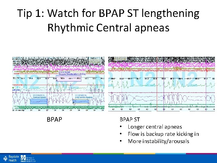 Tip 1: Watch for BPAP ST lengthening Rhythmic Central apneas BPAP ST • Longer