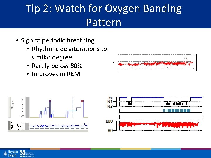 Tip 2: Watch for Oxygen Banding Pattern • Sign of periodic breathing • Rhythmic