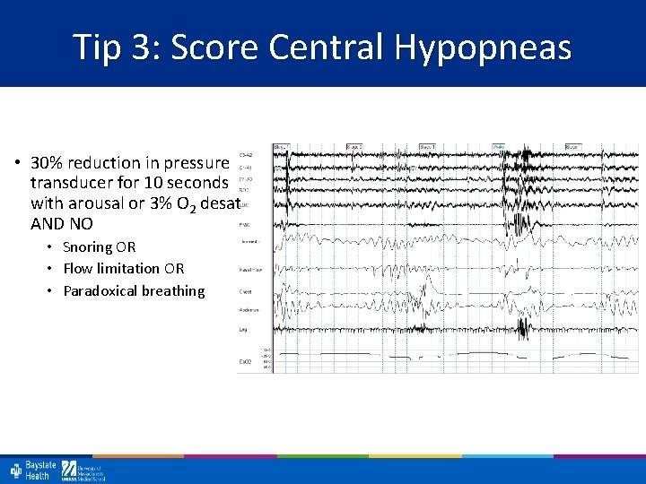 Tip 3: Score Central Hypopneas • 30% reduction in pressure transducer for 10 seconds
